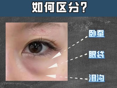 如何区分眼袋和卧蚕（有效方法帮你识别眼部问题，摆脱困扰）