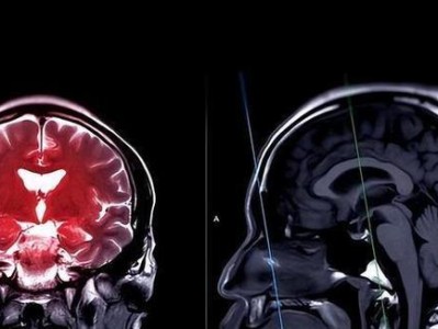 没有大脑的生命会是怎样的？（探索无大脑生物的生存之谜）