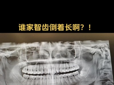 以小辣椒X5为主题的全面评测（一款性价比高的实用手机）